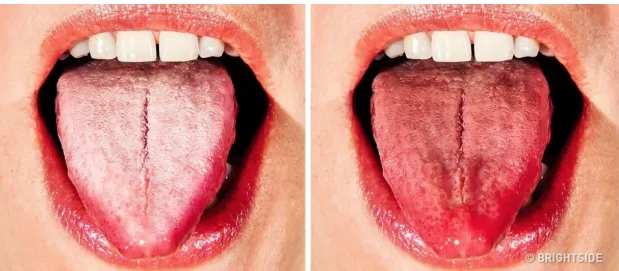 Is a Tongue Scraper Beneficial Reddit Unveiling Truths